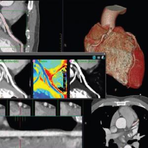 Spectral CT Application Training