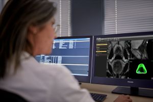 CT Lunch & Learn Webinar 3: CT Oncology with Advanced Visualization